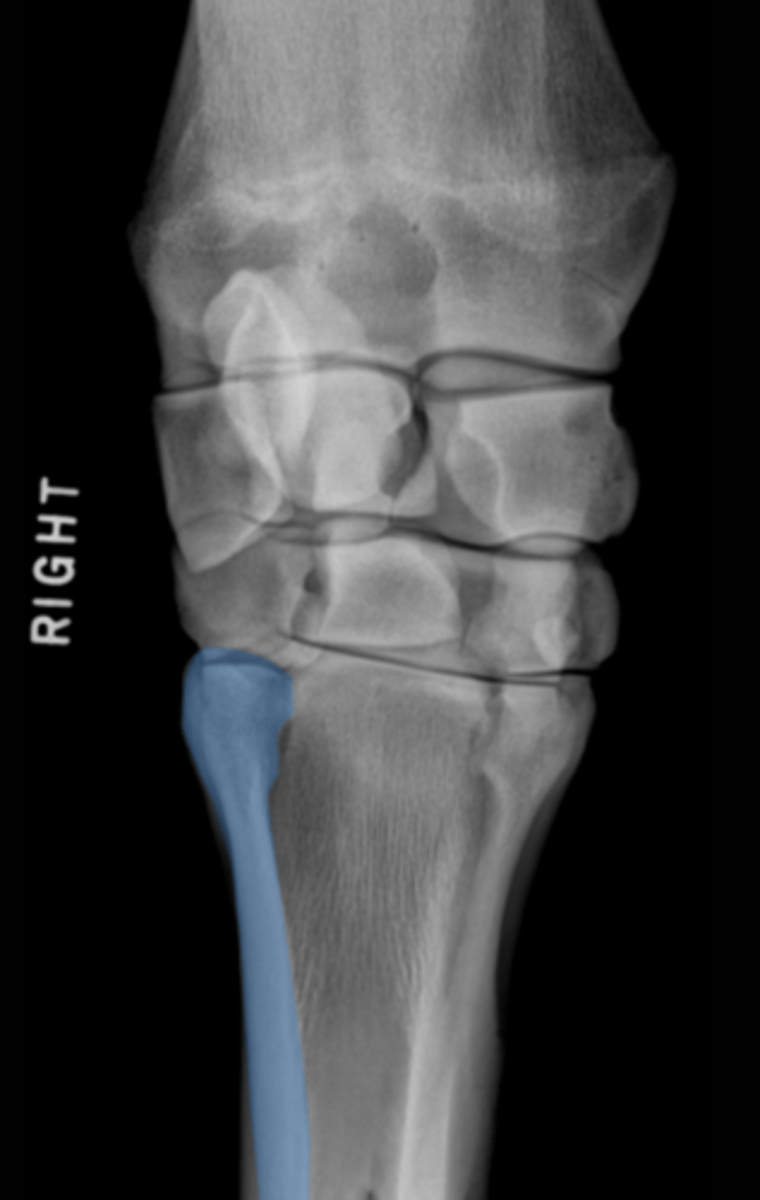 <p>What bone is highlighted?</p>