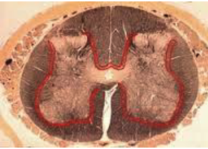 <ol><li><p><strong>short:</strong> typically travel entirely<strong> within gray matter</strong> of cord</p></li><li><p><strong>long:</strong> originate in gray matter but <strong>may leave gray matter</strong> + travel to distant cord segments within the <strong>fasciculus proprius</strong>, a region of white matter adjacent to the gray (red in figure)</p></li></ol><p></p>