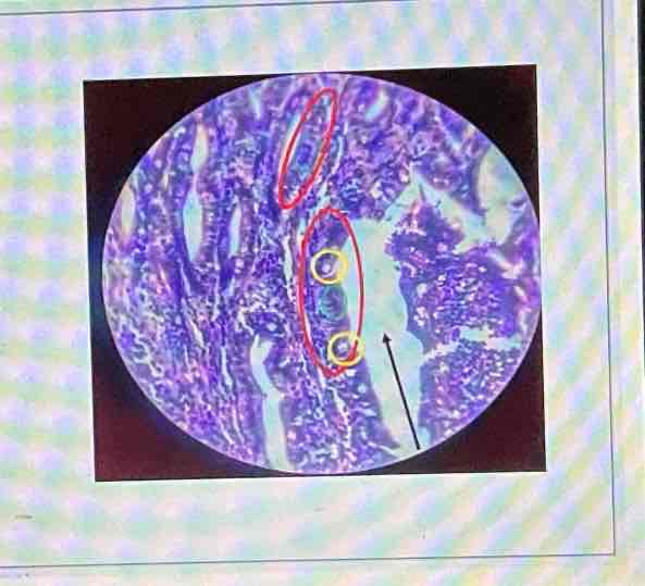 <p><span>What part of the small intestine is shown in the picture?</span></p>