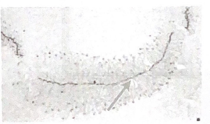 <p>228</p><p>An electron micrograph of a DNA double helix is shown.</p><p>Which one is working at the arrow?</p><p></p><p>a RNA polymerase</p><p>b DNA polymerase</p><p>c Ribosome RNA</p><p>d helicase</p><p>e transfer RNA</p>