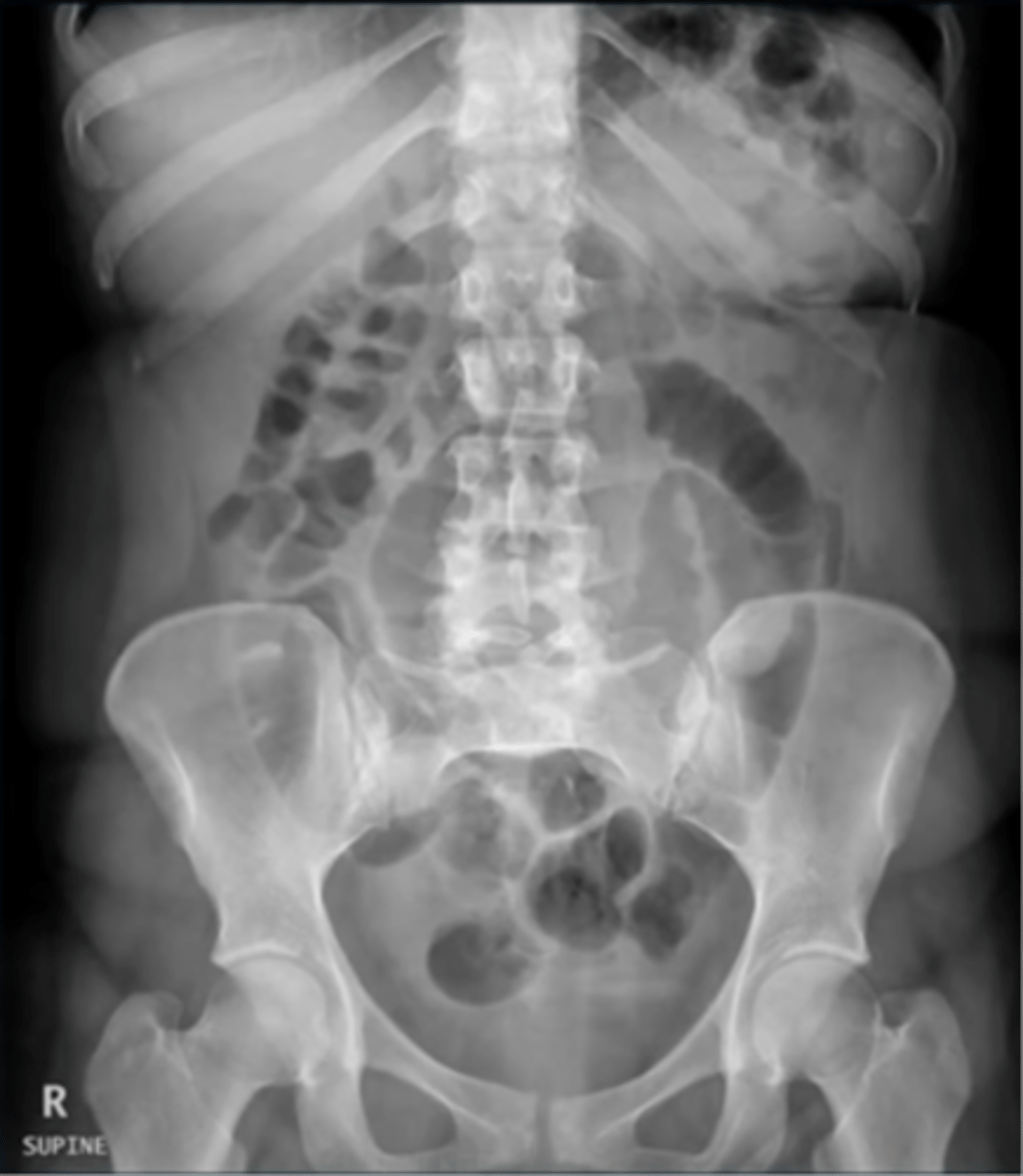 <p>What view is this image in?</p>