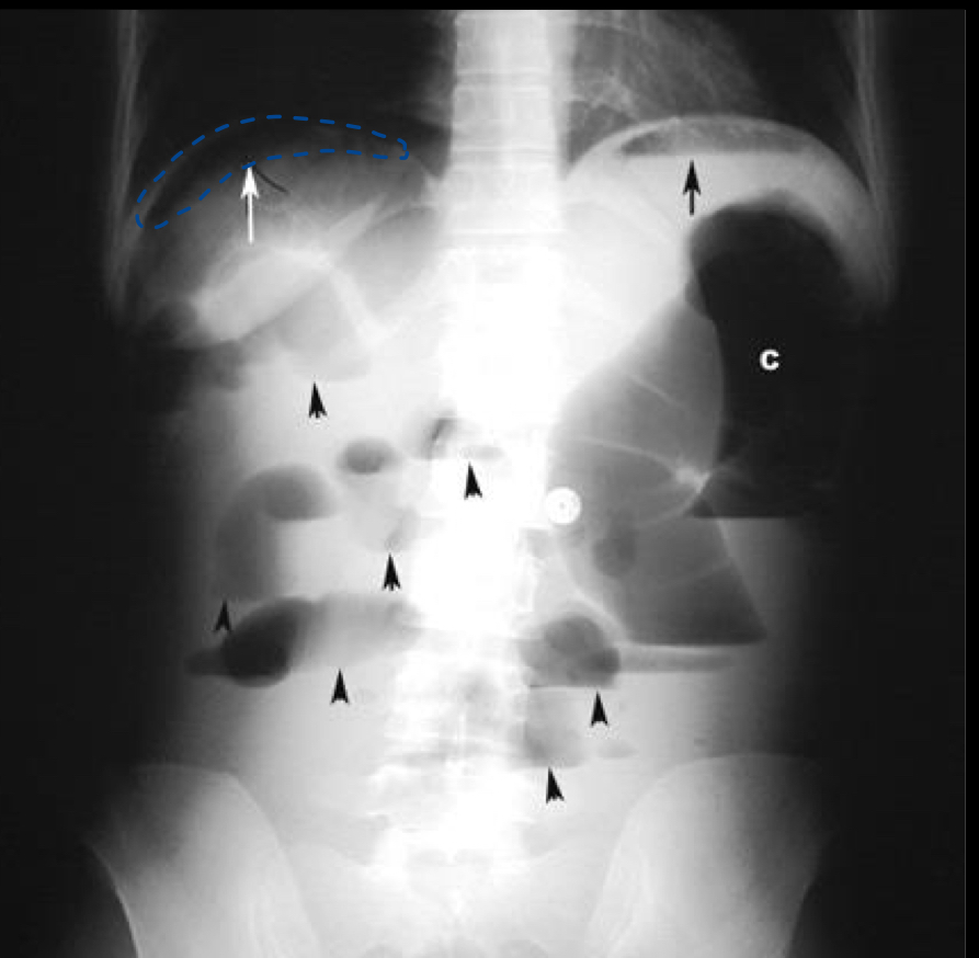 <p>What is indicated by the top right arrow?</p>