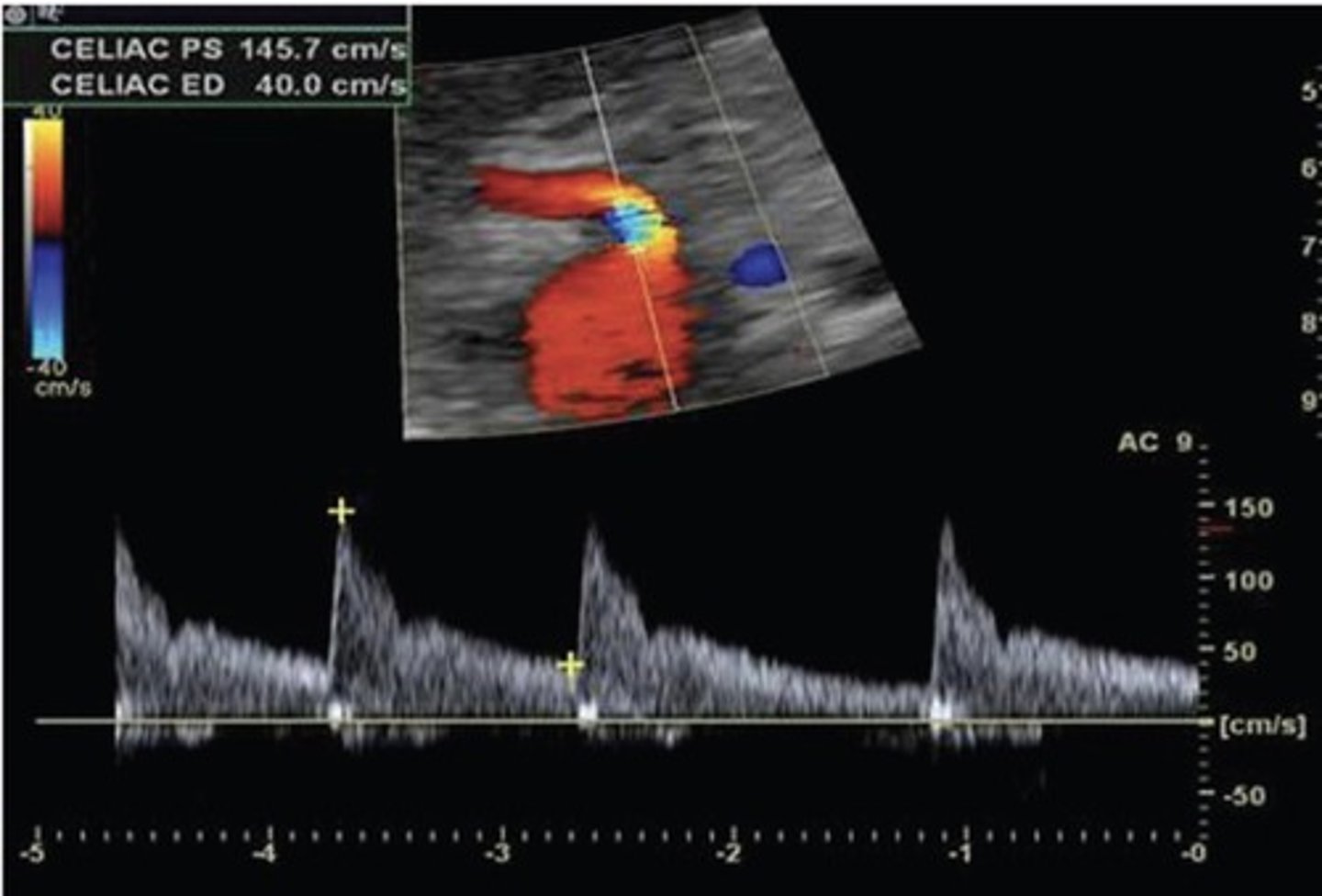 <p>Low resistant</p>