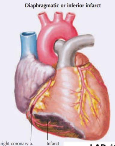 <p>Posterior wall of the left ventricle </p><p>The interventricular septum (if the right is dominant)</p>