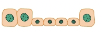 <p>Metaplasia </p>