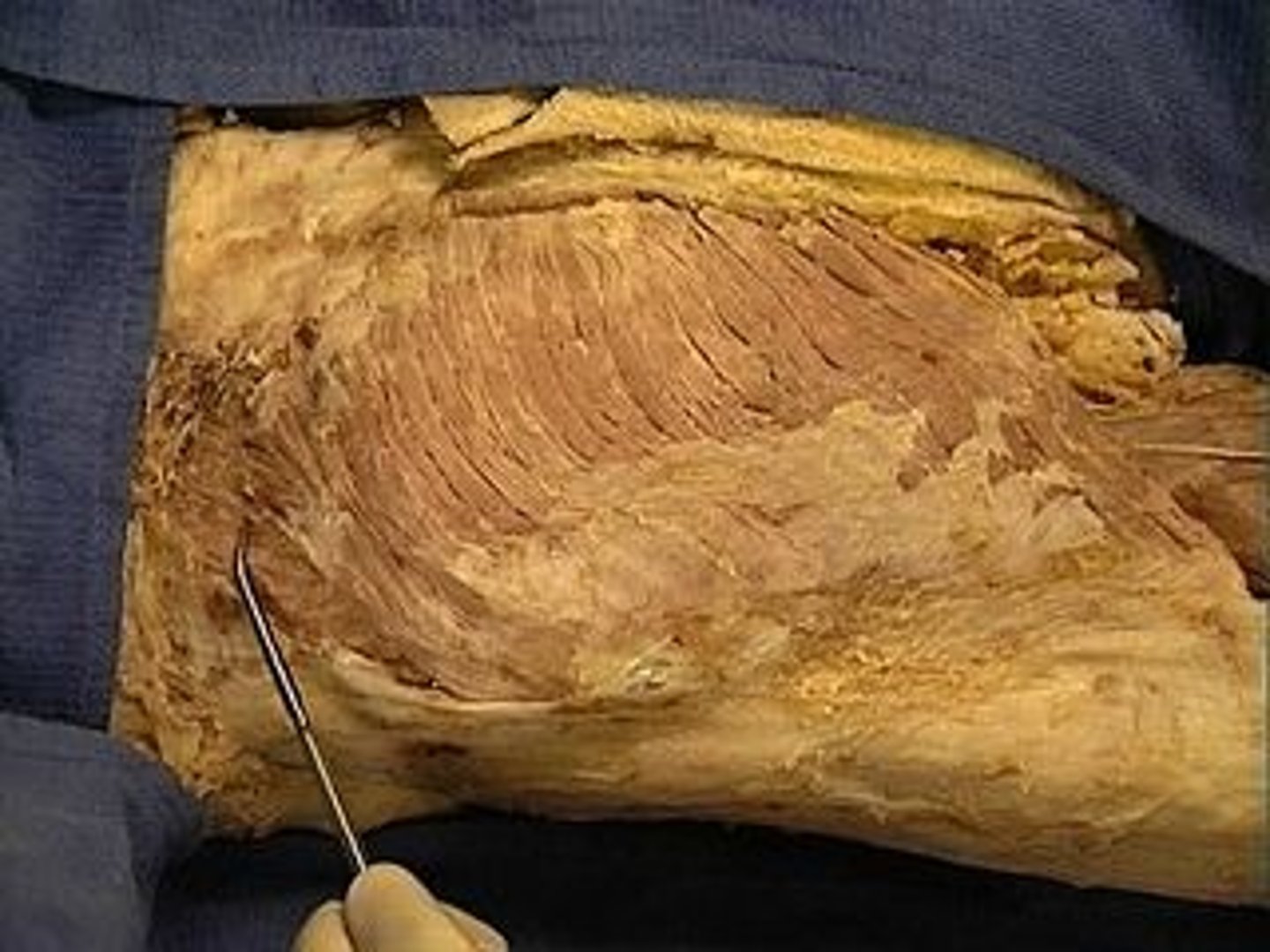<p>Abducts and medially rotates thigh; , Description: Above and partially under Gluteus Maximus</p>