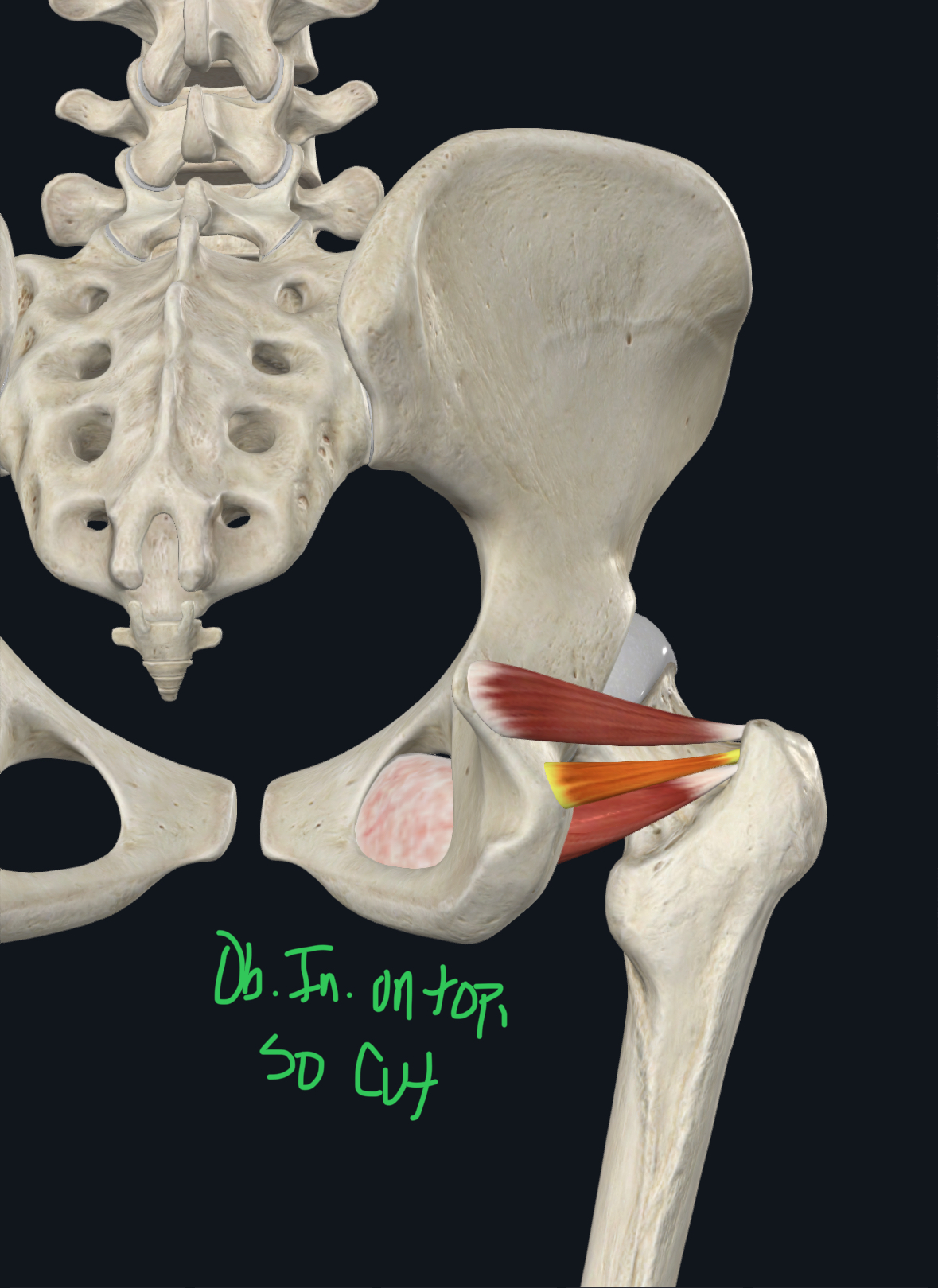 <p>Greater trochanter; blends with the tendon of obturator internus</p>