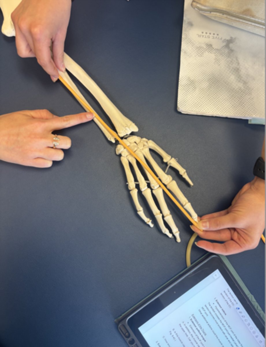 <p>What is this muscle?</p>
