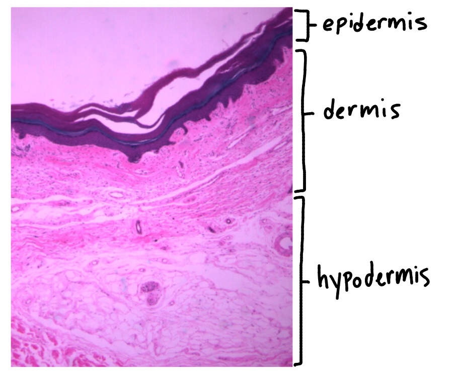 <p>Thick skin</p><ul><li><p>from palm</p></li></ul><p></p><p>A: Epidermis</p><ul><li><p>composed of stratified squamous keratinized epithelial tissue</p></li></ul><p></p><p>B: Dermis</p><ul><li><p>composed of areolar connective tissue (papillary layer) and dense irregular connective tissue (reticular layer)</p></li></ul><p></p><p>C: Hypodermis</p><ul><li><p>composed (mainly) of adipose tissue</p></li><li><p>NOT PART OF SKIN</p></li></ul><p></p>