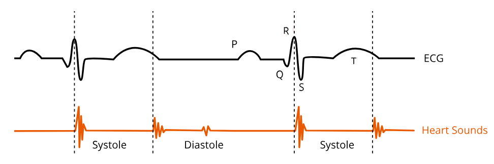 <p>the electrical signal leading up to the semilunar valve closure and the second heart sound.</p>