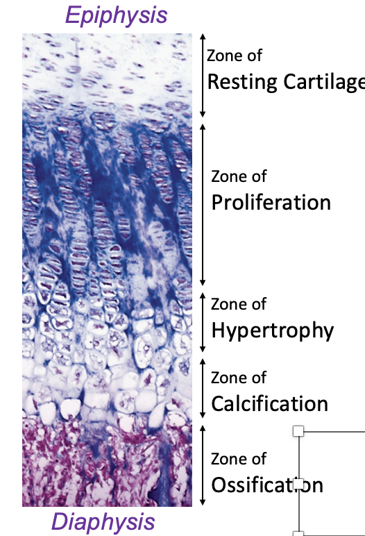 <p>Which zone is this: </p><p>Chondrocytes cease to divide and begin to hypertrophy, walls of lacunae thin</p>