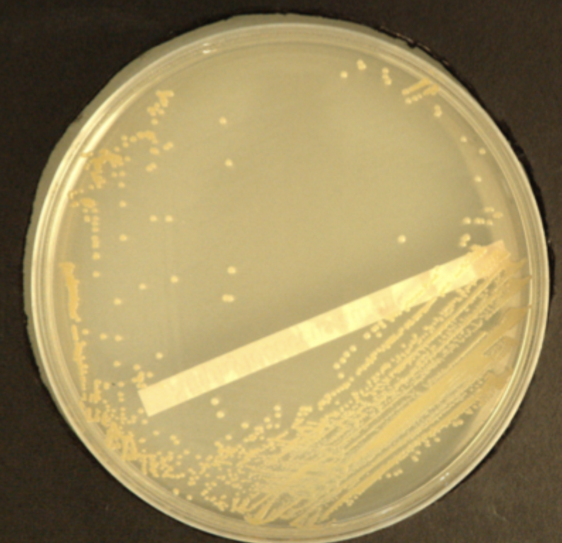 <p>Golden yellow</p><p>Opaque</p><p>Convex</p><p>Round colonies with sharp,clear edges</p><p>Coagulase positive</p><p>Catalase positive</p><p>Gram +</p>