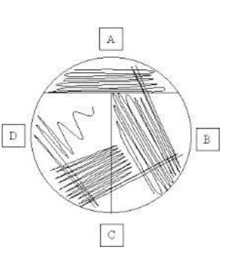 <p>Which of the labeled areas of streaking is pure culture obtained? (Answer in letter)</p>