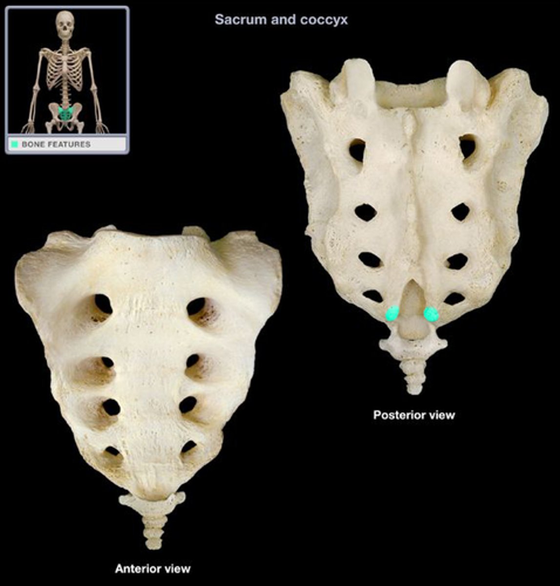 <p>Sacrum - hornlike projections</p>