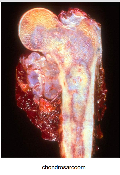 <ul><li><p>femur</p></li><li><p>in merg van het bot: kraakbeen → is normaal niet zo</p></li><li><p>kraakbeen in de spier</p></li></ul><p></p>