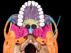 <p>the depression in the temporal bone into which the condyle of the mandible fits</p>