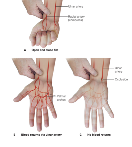 <p>Which test is being shown in this image?</p>