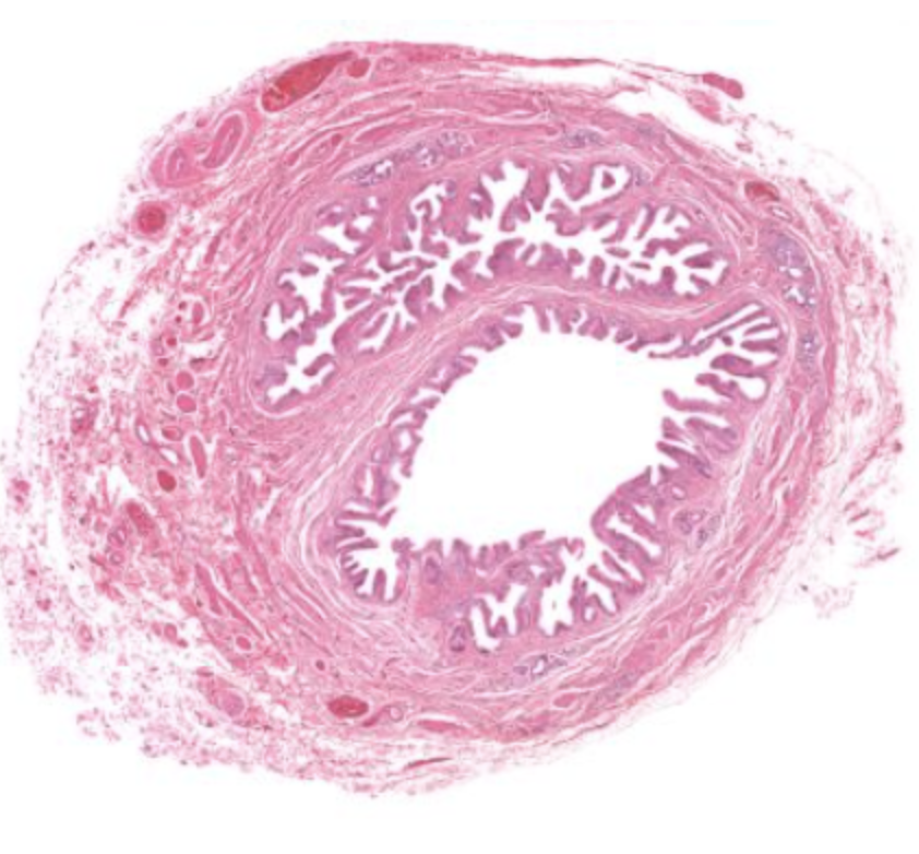 <p>Epithelial tissue that consists of a single layer of flattened cells. The thinness of these cells facilitates the transfer of materials (e.g., gases, fluids or nutrients) across the epithelium.</p>