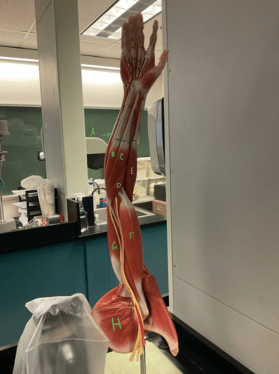 <p>subscapularis</p>