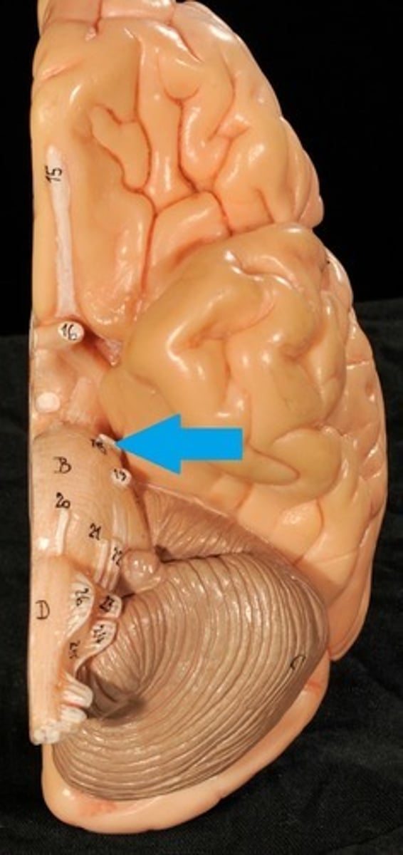 <p>Motor: Eye movements</p>