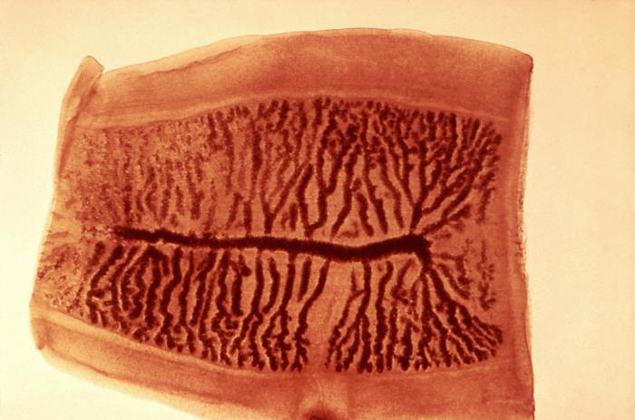 <p><span>Important diagnostic information can be provided by correct identification of the gravid proglottid shown below. Which tapeworm species produces this type of proglottid?</span></p><p>Diplyllobothrium latum</p><p>Hymenolepis diminuta</p><p>Hymenolepis nana</p><p>Taenia saginata</p><p>Taenia solium</p>