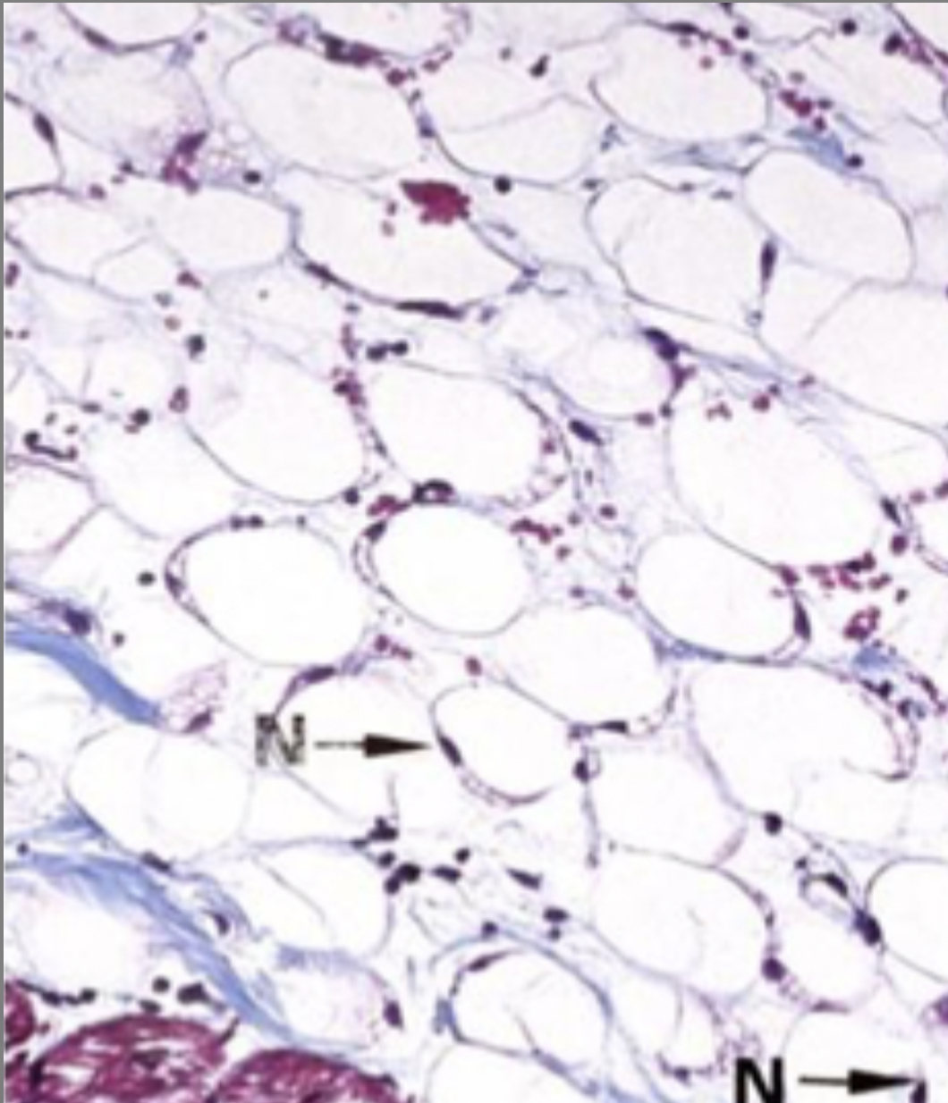 <p>‘chicken wire’ appearance, each adipocyte is supported by delicate network of collagen and reticular fibres, fibrocytes, mast cells, sparse amorphous ground substance, rapid turnover of lipid</p>
