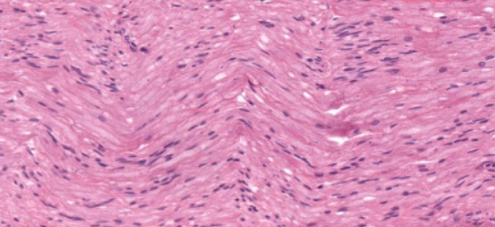 <p>(fiber type)</p>