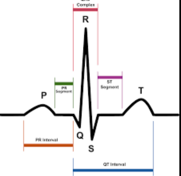 <p>Identify the region of the ECG that corresponds to ventricular depolarization</p><p>&nbsp;</p><ol><li><p>T</p></li><li><p>P</p></li><li><p>SA node</p></li><li><p>QT Interval&nbsp;</p></li><li><p>ST Segment</p></li><li><p>PR Interval</p></li><li><p>QRS Complex</p></li><li><p>Q</p></li><li><p>&nbsp;PQ segment</p></li></ol>