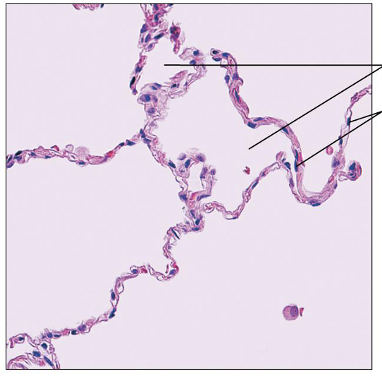 <p>What is this tissue, and where is it found?</p>