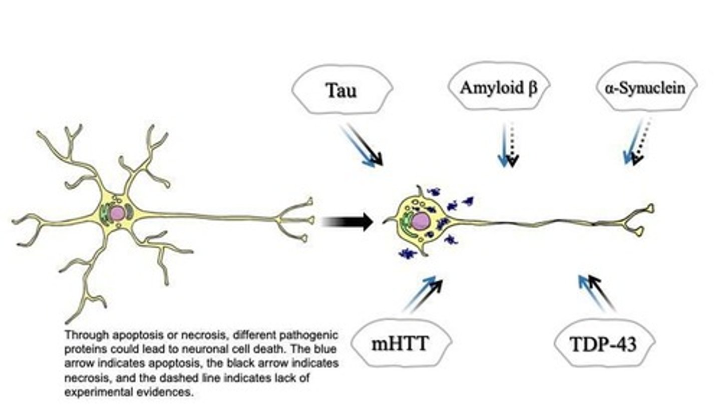 <p>Masses of paired helical filaments filled in nerve cell bodies, arising from hyperphosphorylation of tau protein.</p>