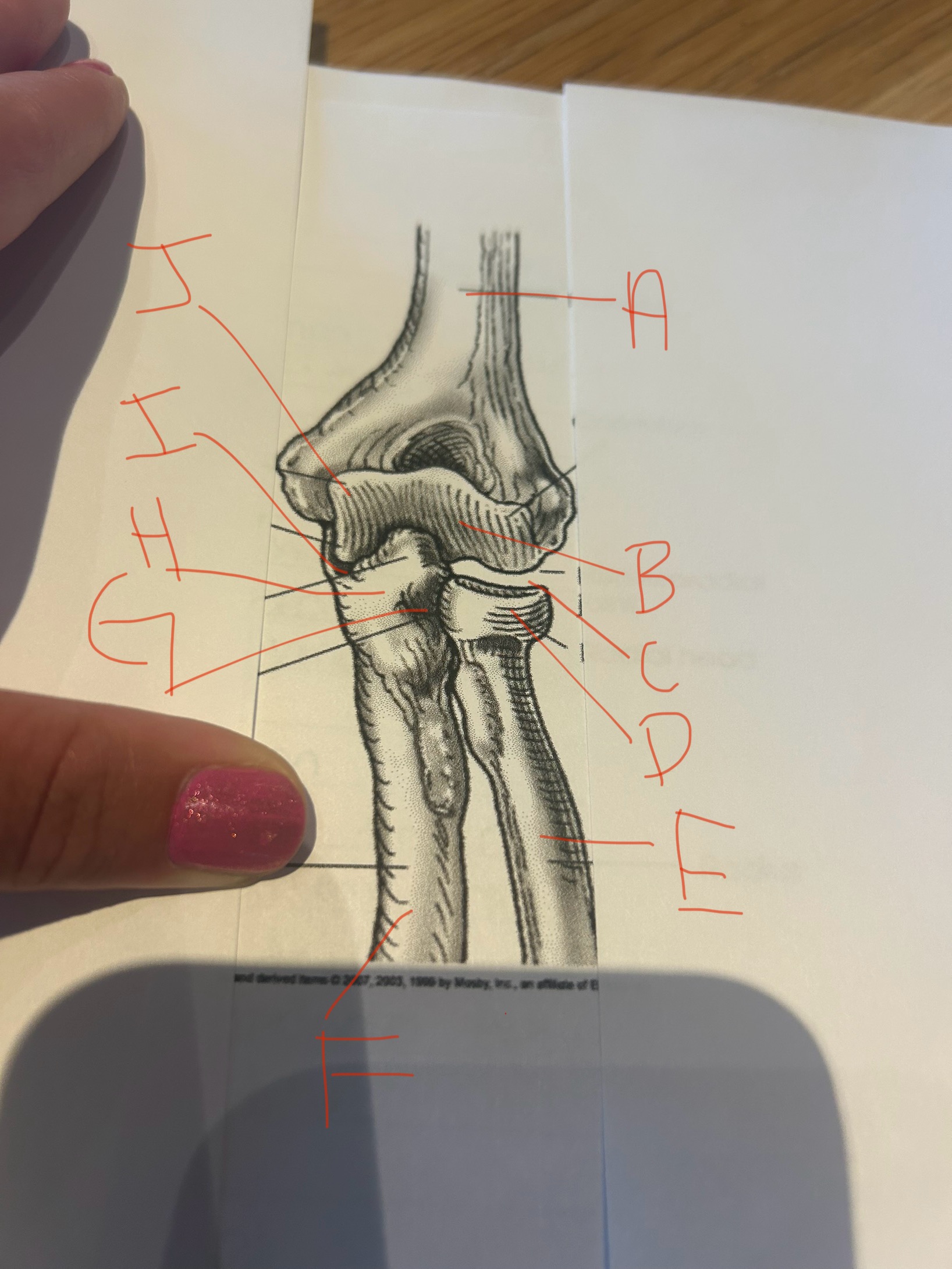 <p>label this image</p>
