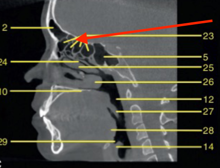 <p>identify the structures</p>