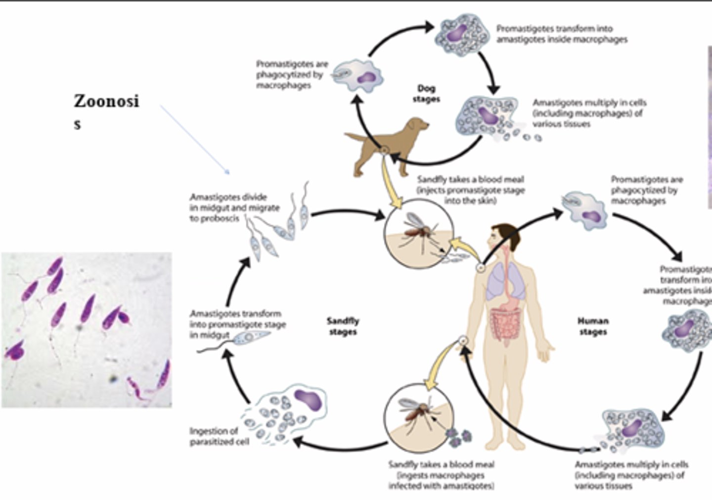 <p>an infection indigenous to animals but naturally transmissible to humans</p>