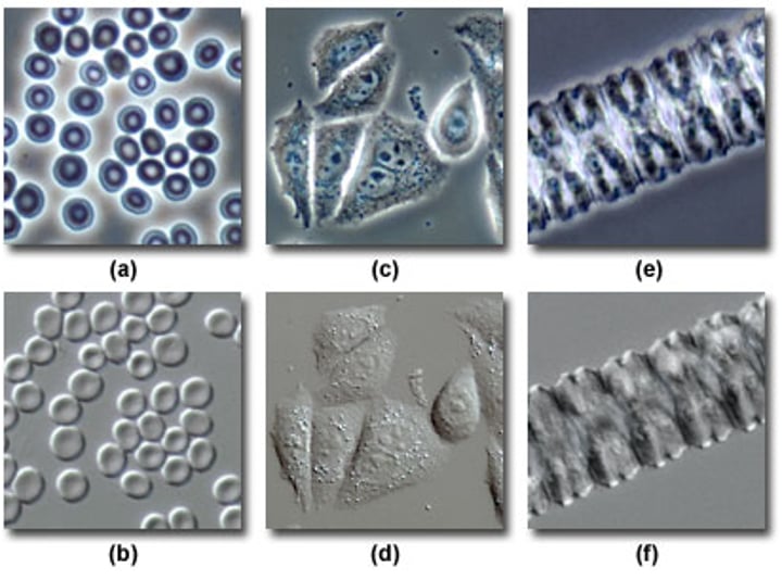 <p>Pros: Can view living organisms, does not require staining, high contrast and resolution</p><p>Cons: Not good for thick samples, distorted "halo" around images</p>