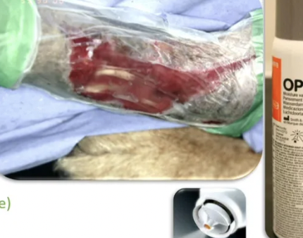 <p><u>Example:</u> Opsite flexigrid and opsite spray</p><p><u>Material:</u> Thin adhesive film often used to stick primapore on</p><p><u>Function:</u> Semi-permeable (aids in moist wound healing BUT impermeable to contaminants and bacteria)</p><p><u>Indication:</u> Protective barrier against irrigation/urine/discharge</p><ul><li><p>Clean wounds with NO exudate</p></li></ul><p></p>