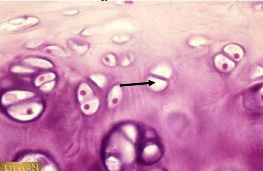 <p>Name the “hole” the arrow is pointing to?</p>