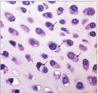 <p>What is interstitial growth?</p>