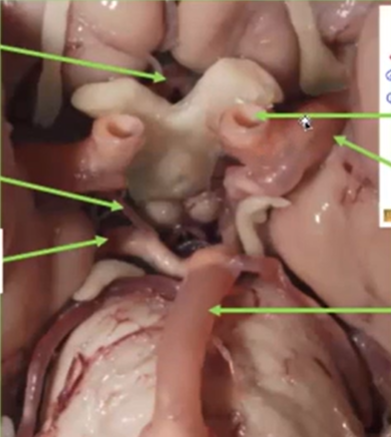 <p>Internal carotid is tube<br><br>Optic nerve is white tissue</p>