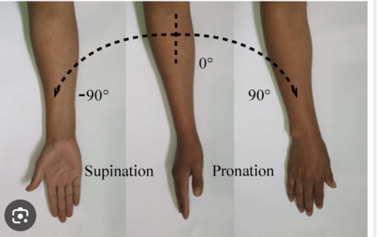 <p>Rotation of the forearm so that the palm faces down (prone position)</p>