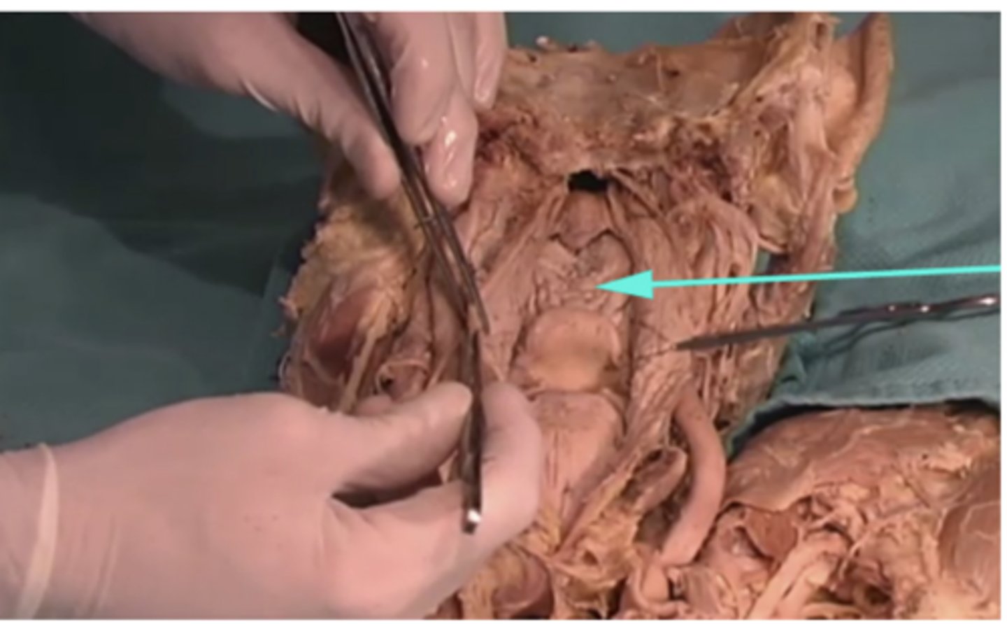 <p>What is the name of this region as indicated by the arrow?</p><p>-larynx</p><p>-peripheral proteins</p><p>-dorsum of the tongue</p><p>-soft palate</p>