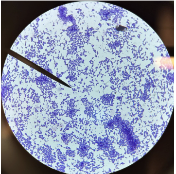 <p>gram positive rods (smaller): </p>