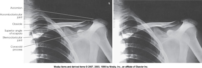 <p>What position is demonstrated?</p>