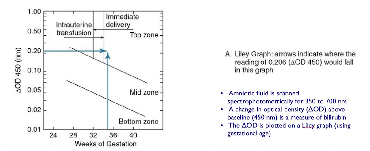 <p> ΔOD is plotted on a Liley graph (using gestational age)</p><ul><li><p>Upper zone (zone 3): severe HDFN</p></li><li><p>Middle zone (zone 2): moderate disease</p></li><li><p>Lower zone (zone 1): mild disease</p></li></ul><p></p>