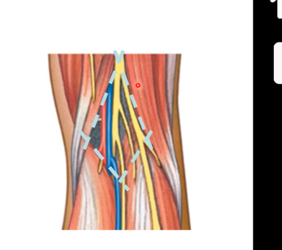 <ul><li><p>diamond shaped depression on posterior aspect of thigh</p></li><li><p>borders consist of the two heads (medial and lateral head ) of gastrocnemius and hamstrings</p></li><li><p>floor is popliteus muscle</p></li><li><p>roof is skin</p></li><li><p>top part of diamond is hamstring muscles. bottom half is gastrocnemius</p></li></ul><p></p>