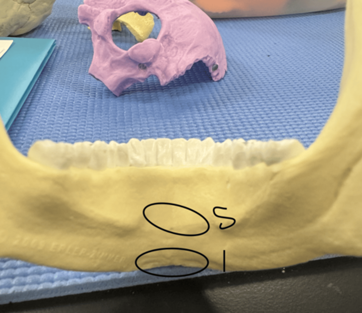 <p>can see on real bone</p>