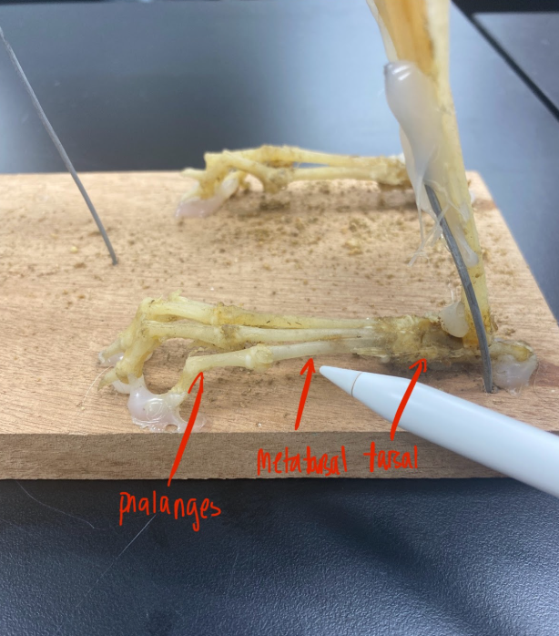 <p>Phalanges, metatarsal, tarsal</p>