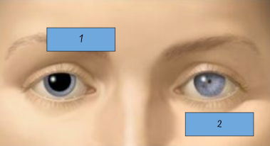 <p>Label each eye</p>