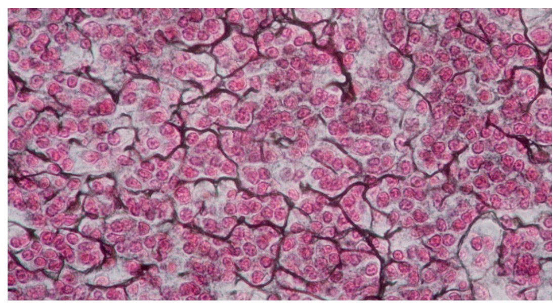 <p>Identify the type of tissue and the<br>location </p>