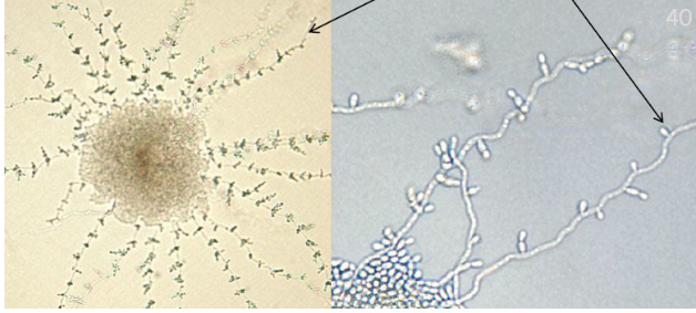 <p>This organism was collected from an immunocompromised patient with prolonged antibiotic use. The images below are from the cornmeal slide culture of this organism. What is the identification of this organism?</p>