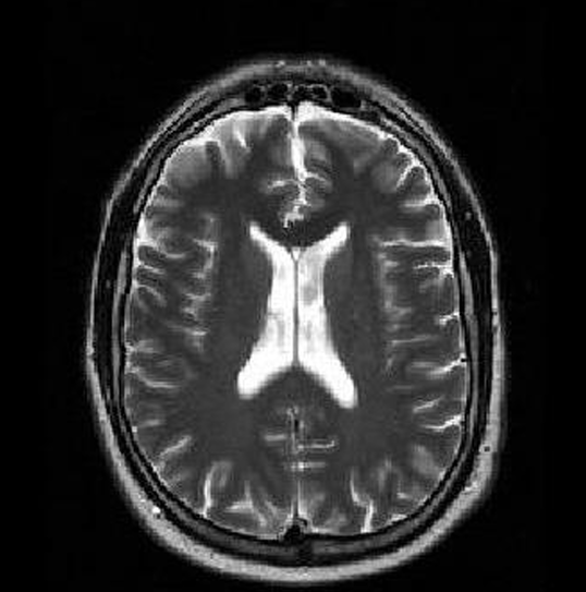 <p>MRI T1, MRI T2, CT, or PET</p>